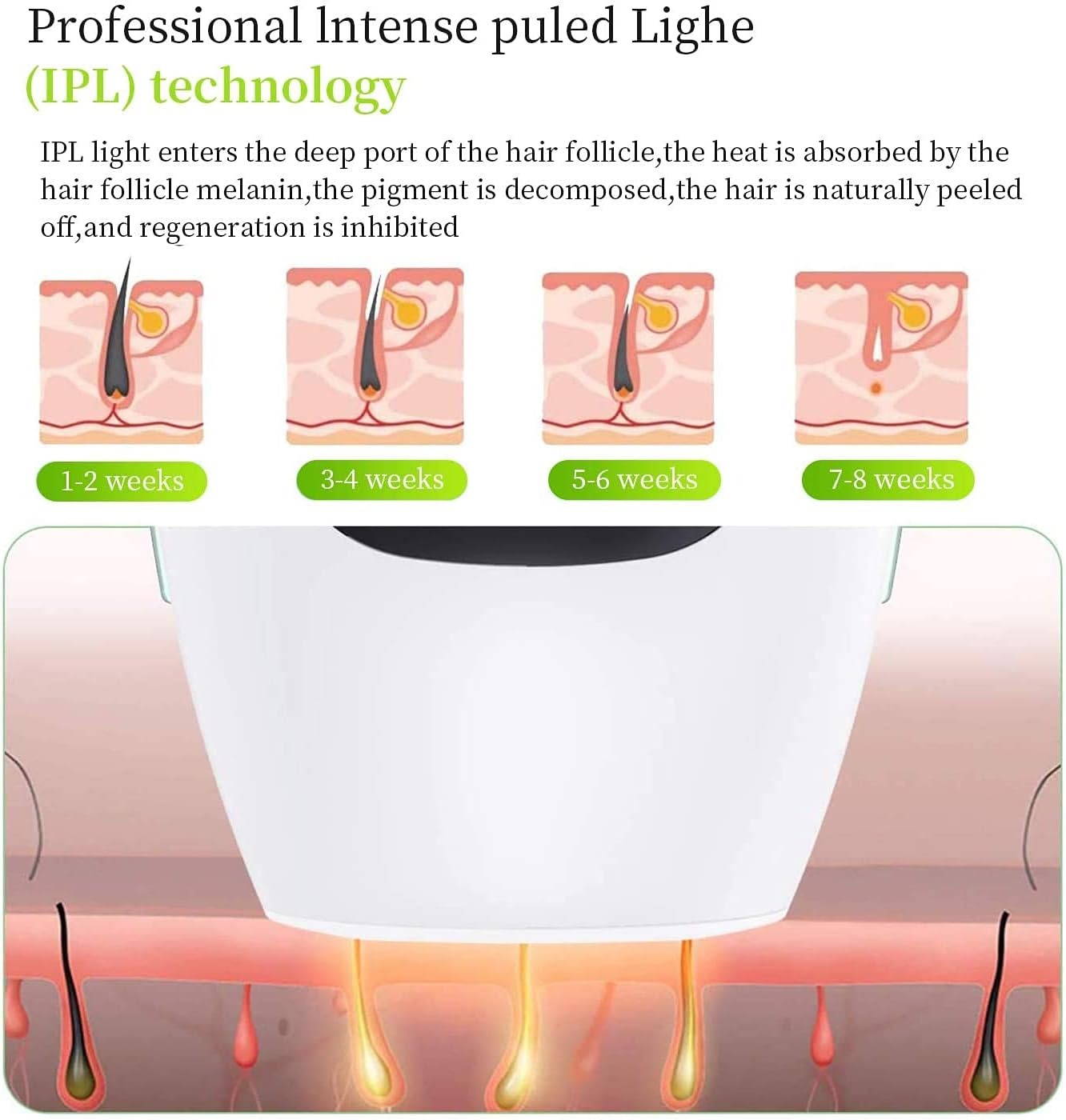 IPL Laser Hair Removal System – Permanent Hair Reduction for Women & Men